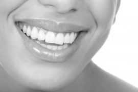 Laser Teeth Whitening London Service