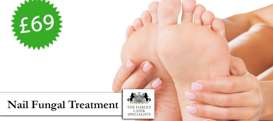 Nail-fungal-treatment-special-offer