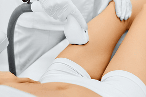 Laser Hair Removal London Tips