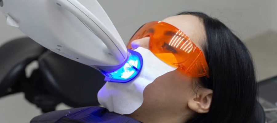 laser whitening 3