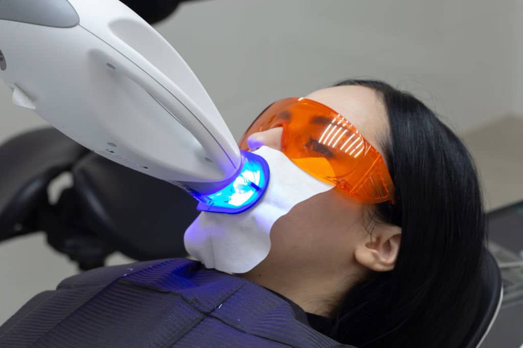 Why Should You Be Harley Street Certified in Laser Teeth Whitening