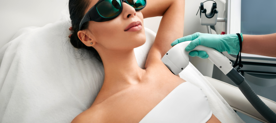 Candela Laser
