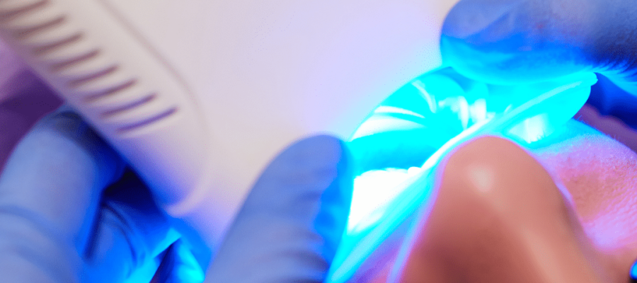 laser teeth whitening