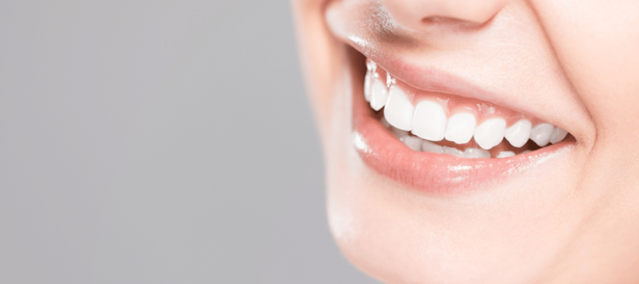 teeth whitening