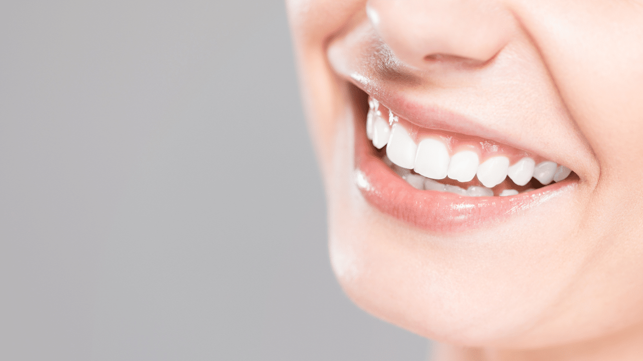 teeth whitening