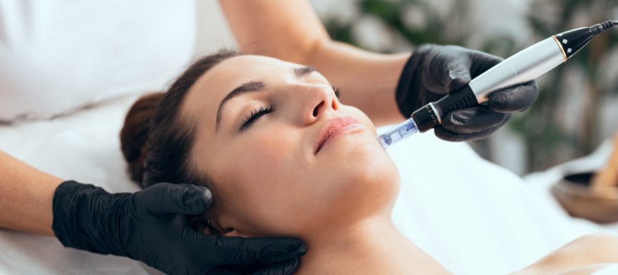 microneedling