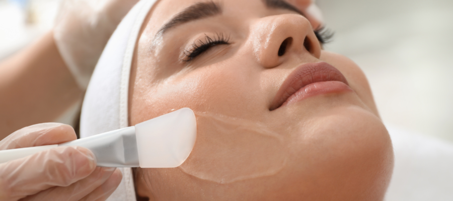Chemical Peel