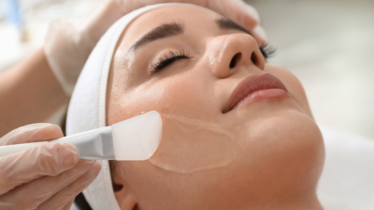 Chemical Peel