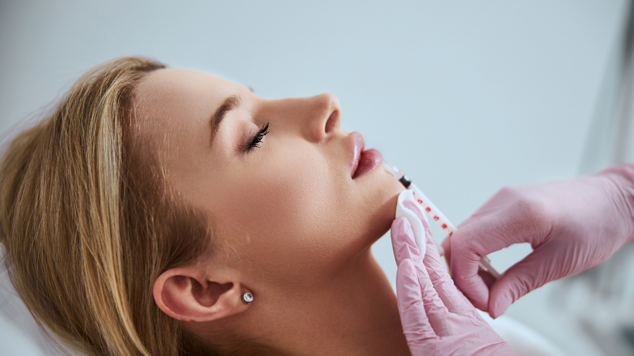 dermal filler