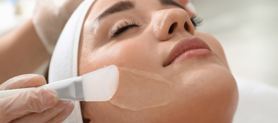 chemical peel