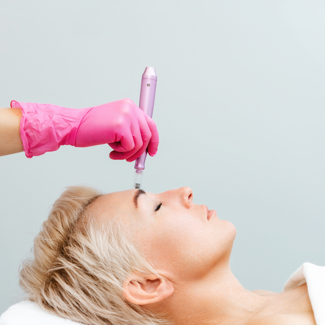 Microneedling