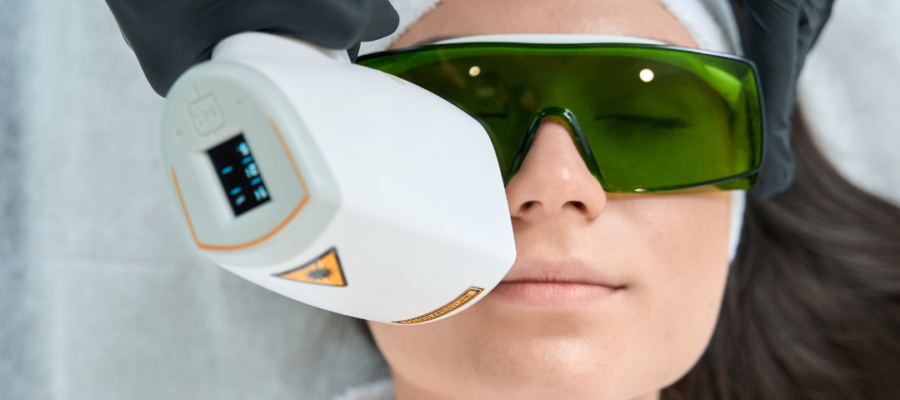 Laser vs Chemical Peels