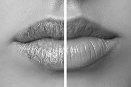 lumi-skin-lips