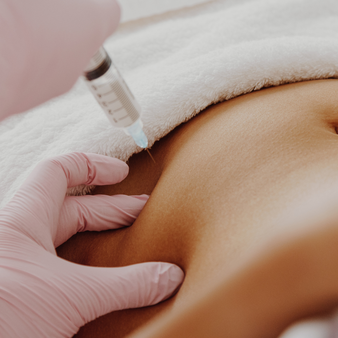 Reasons to Choose Cryolipolysis