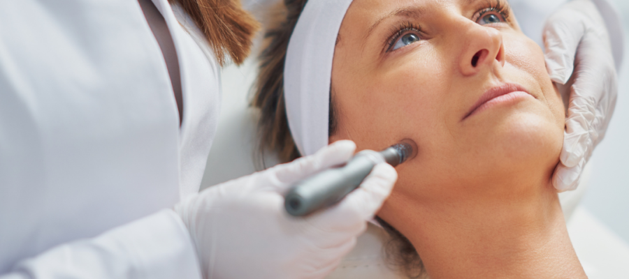 Microneedling Improve Skin Texture