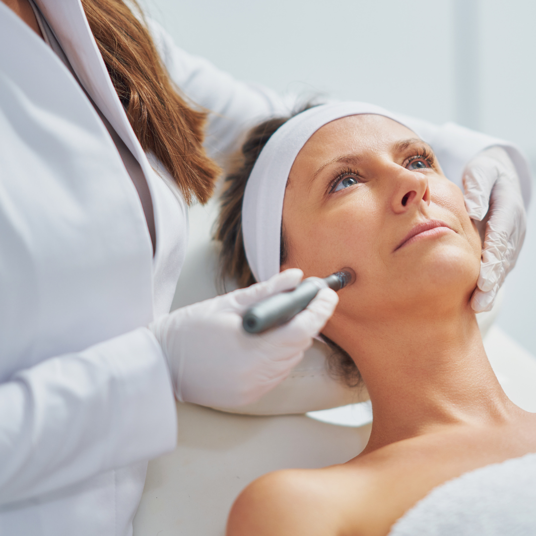 Microneedling Improve Skin Texture