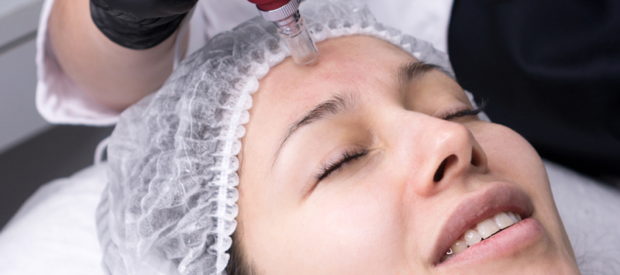 Microneedling Tighten Loose Skin