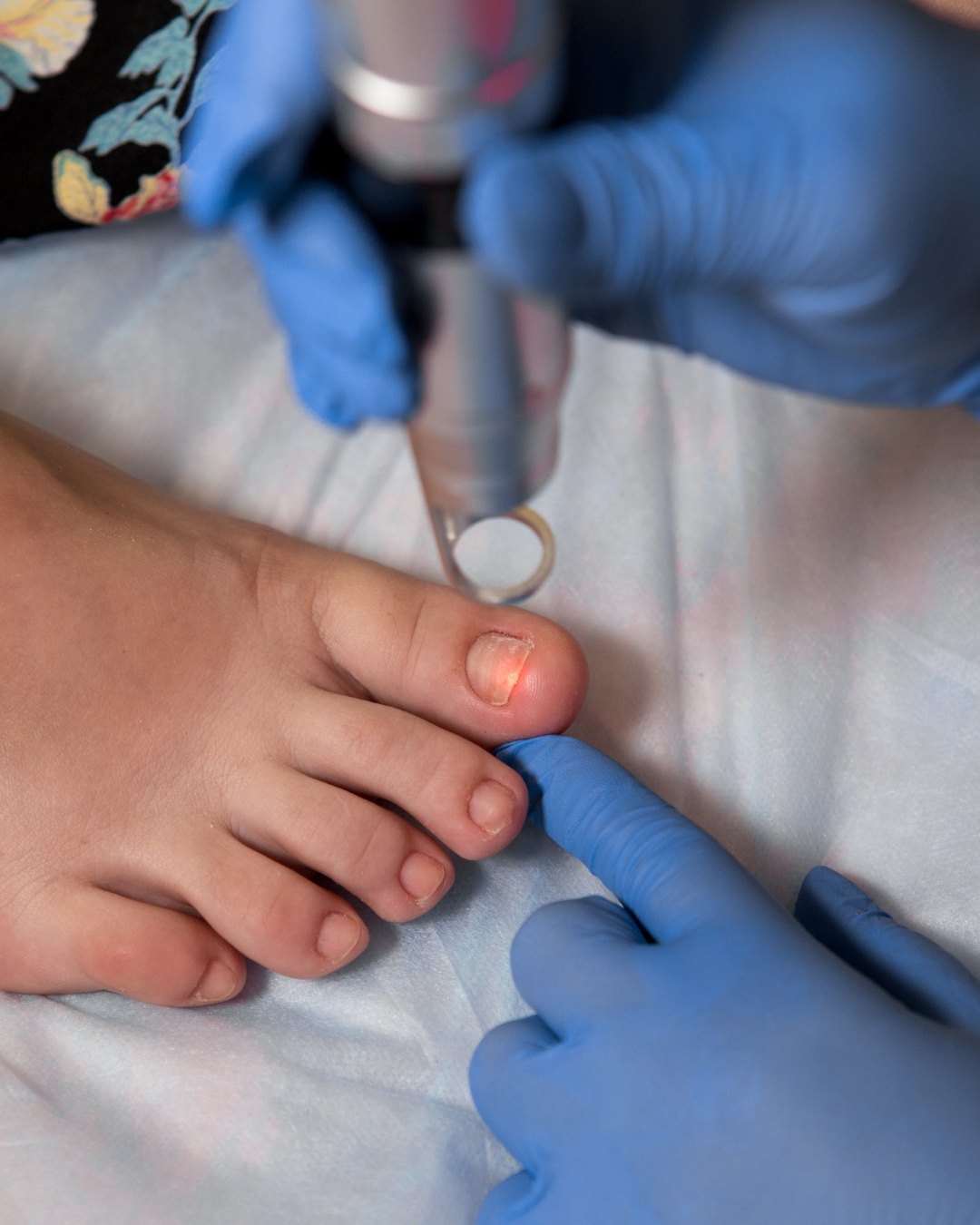 Home Remedies Work for Nail Fungus